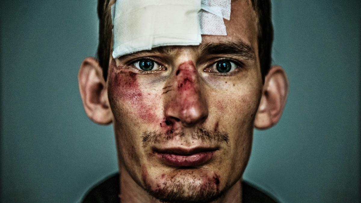 a man with a bandaged eye and a piece of paper on his forehead